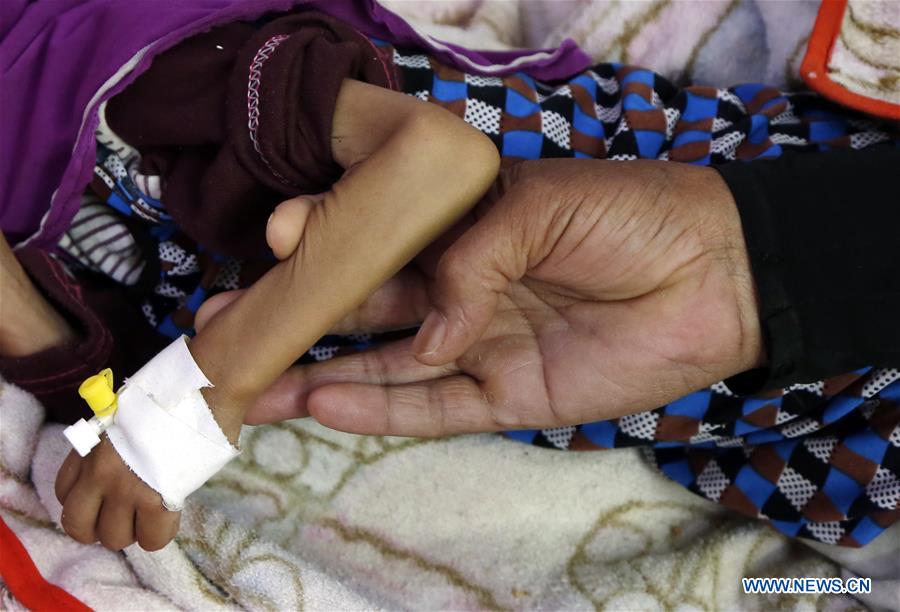 YEMEN-SANAA-CHILDREN-MALNUTRITION