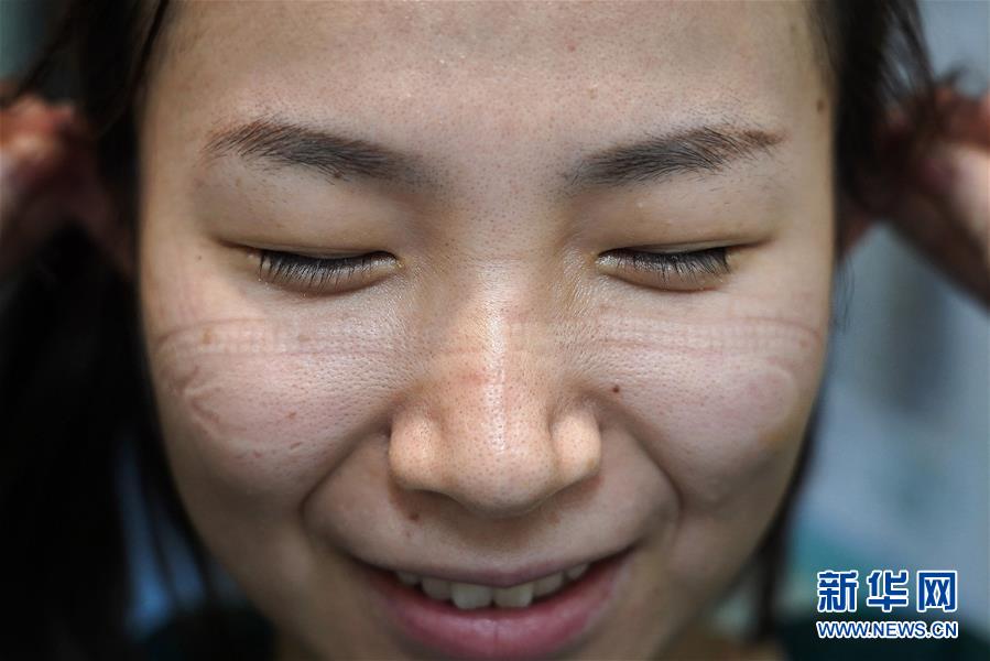 (聚焦疫情防控)(4)“最美印痕”